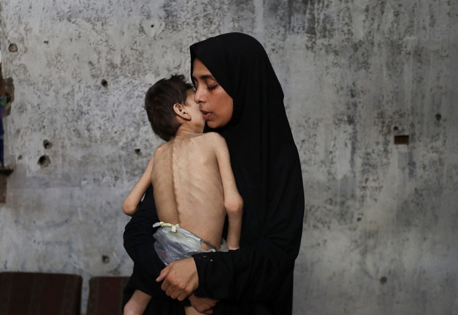 'They are losing hope': what doctors, humanitarian workers are seeing in Gaza in the midst of the hunger crisis